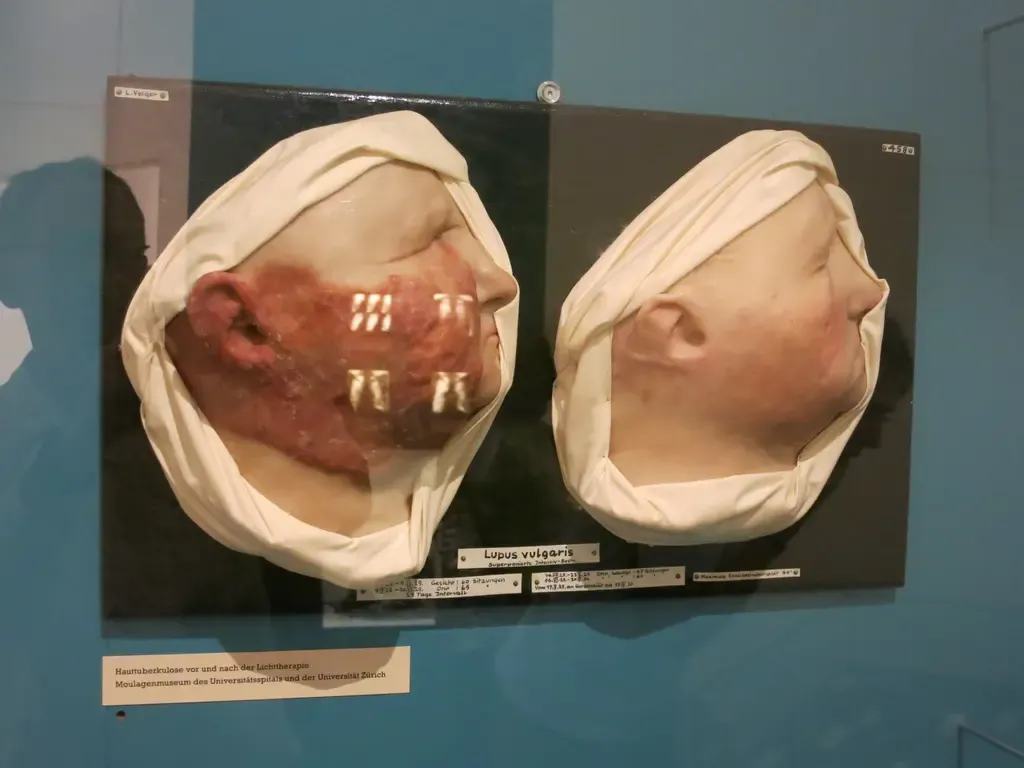 museum of wax moulages